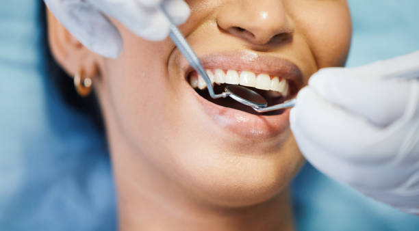 Best Emergency Wisdom Teeth Removal in Crownsville, MD